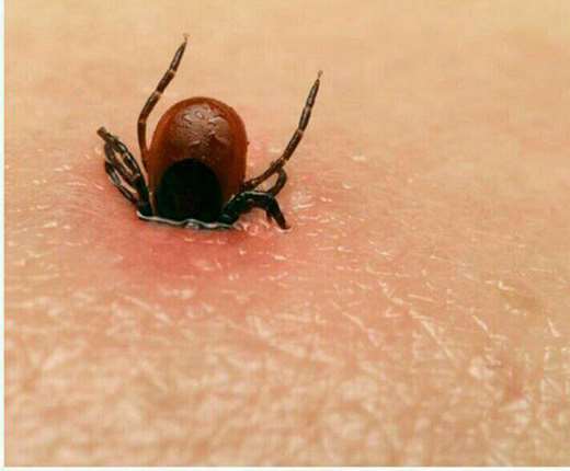 تب کریمه کنگو